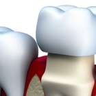 Portland Periodontics-David A. Goldwyn, DDS, PC