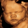 Mother Nurture 3D/4D Ultrasound