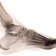 Bethlehem Podiatry: Fallon-Kline Foot and Ankle