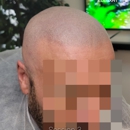 Elegant Scalp Micropigmenetation - Scalp Care