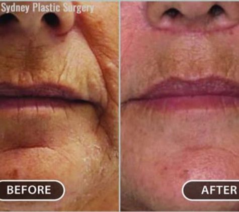 Sydney Plastic Surgery - Dr Barnouti - Parramatta, NSW