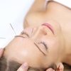 Pinebrook Acupuncture gallery