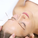Pinebrook Acupuncture - Allergy Treatment