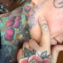 Medora Laser - Tattoo Removal