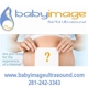 Baby Image 3d 4d Ultrasound