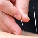 Elite Acupuncture - Acupuncture