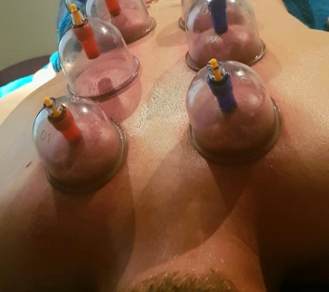 Anna's Sports and Rehabilitation Massage - High Wycombe, WA. I was amazed at how tight my shoulder were. Cupping definitely made the massage more effective.