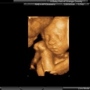 A Baby Visit 4D Ultrasound