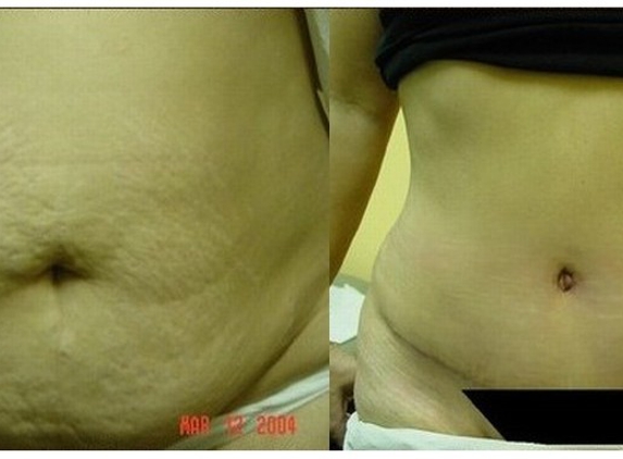 Venus Cosmetic Surgery - Doral, FL