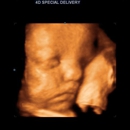 3D 4D Ultrasound by 4D Special Delivery - Medical Imaging Services