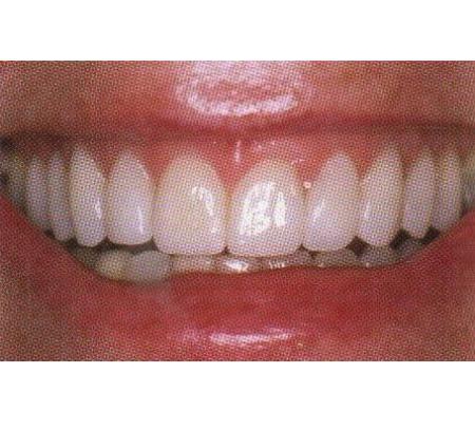 Avondale Heights Dental Clinic