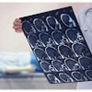 First Choice Neurology - Physicians & Surgeons, Neurology