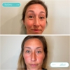 Prana Med Spa gallery