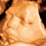 Clear Image 4D Ultrasound : Brooklyn