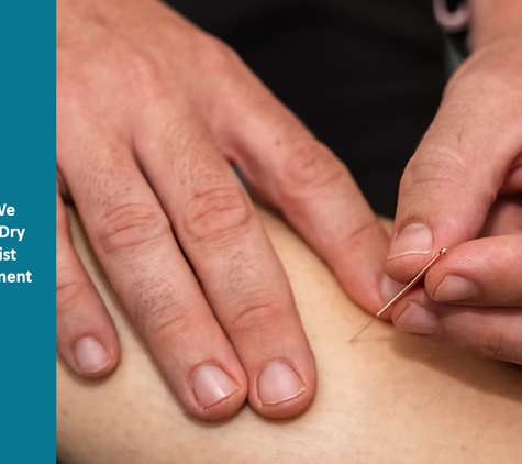 Shellharbour Sports Physio - Shell Cove, NSW. At Shellharbour Sports Physio, We Commonly Use Dry Needling To Assist With The Treatment