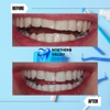 Northern Valley Family Dentistry gallery