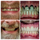 Love Your New Smile: Dr Peter Diacoloukas - Dentists