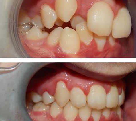 Glenn Carty Orthodontist - Gungahlin, ACT