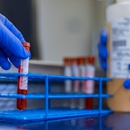 Grifols Freedom Plasma Donation Center - Louisville - Blood Banks & Centers