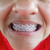 Lovett Dental gallery