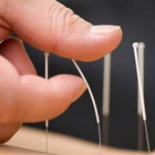 Springer Acupuncture
