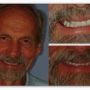 Blaisdell Family Dentistry - Cosmetic Dentistry