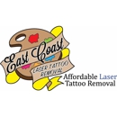 East Coast Laser Tattoo Removal - Tattoo Removal