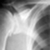 Kuo Dr Warren Orthopaedic Surgeon - Dr Warren Kuo Orthopaedic Surgeon - St Vincents SportsMed