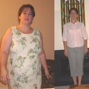 Gastric Sleeve Mexico - Health & Fitness Program Consultants