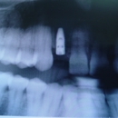 Southern Georgia Oral Surgery - Implant Dentistry