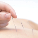 Blue Dragon Acupuncture - Acupuncture