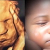 Chubby Cheeks 3D/4D Ultrasound Studio of High Point & Greensboro gallery