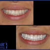Dr. Bard J. Levey, DDS gallery