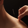 Cochise Acupuncture gallery