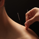 Cochise Acupuncture - Acupuncture