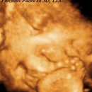 Precious Faces in 3D, LLC - Physicians & Surgeons, Obstetrics And Gynecology