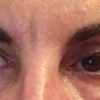 Derma Laser gallery