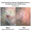 Bruce P. Robinson, MD - Physicians & Surgeons, Dermatology