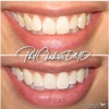 Just Smiles - General, Cosmetic & Implant Dentistry gallery