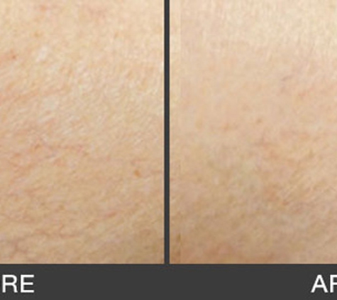 South Coast Skin & Vein Clinic - Wollongong, NSW