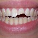 Markowitz Dental of Washington DC - Dentists