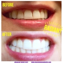 Advanced Dental Care - Implant Dentistry