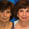 Patel Plastic Surgery gallery