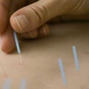 Elgin Acupuncture & Herbs - Acupuncture