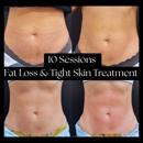 Kathleen D. Aesthetics - Massage Services