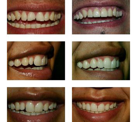 Smile Select Dental - Chino Hills, CA