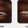GentleCare Dentistry gallery