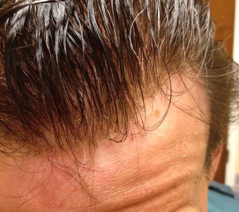 Thinning Hair Solutions - Stamford, CT