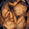 Your 4D Baby gallery