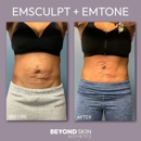 Beyond Skin Aesthetics - Skin Care